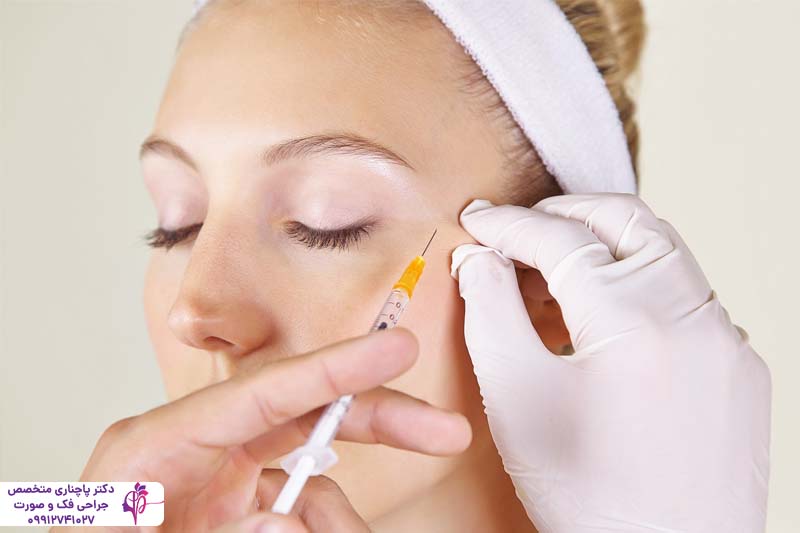 تزریق پروفایلو برای جوانسازی