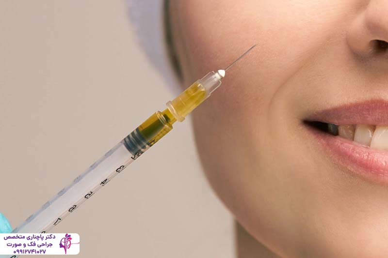 تزریق پروفایلو برای جوانسازی