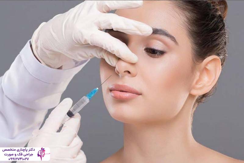 جراحی بینی گوشتی با غضروف ضعیف