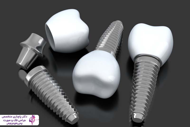 ایمپلنت سرامیکی یا پایه تیتانیومی