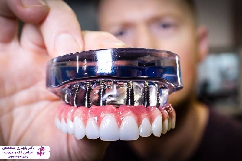 مقایسه پروتز و ایمپلنت دندان