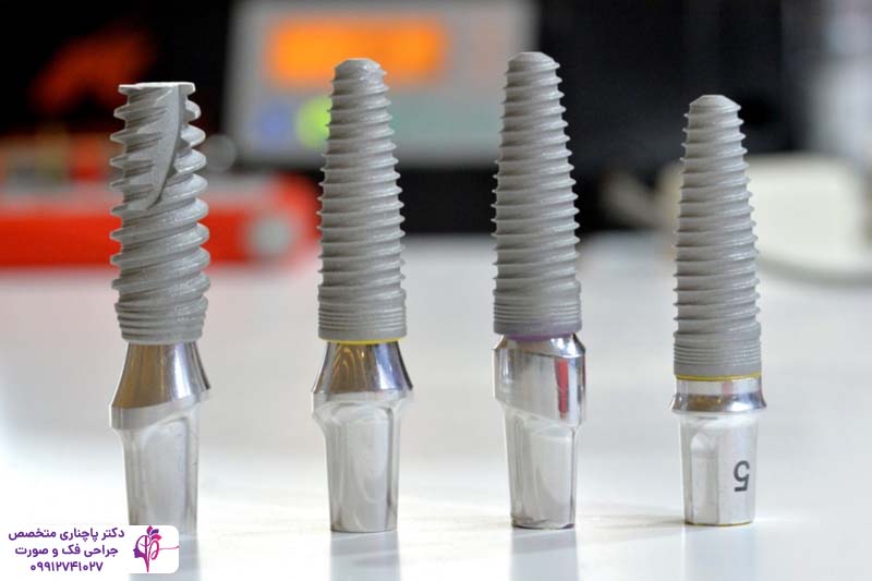 ایمپلنت سرامیکی یا پایه تیتانیومی