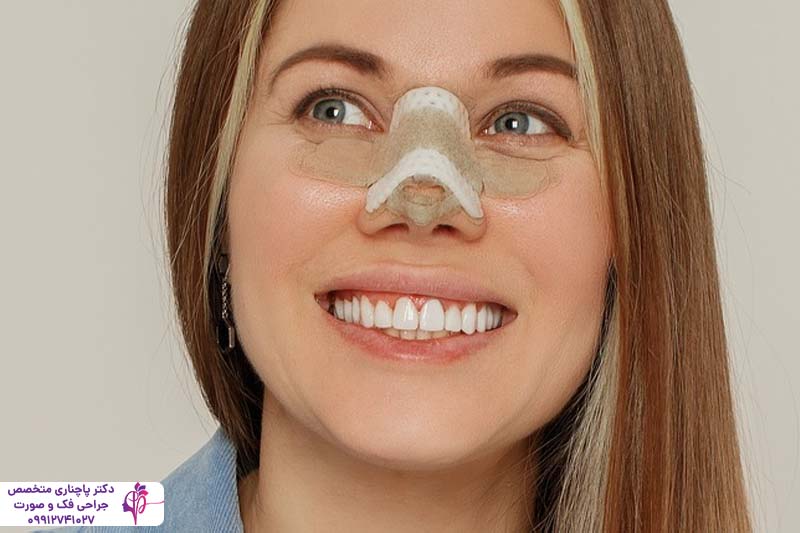 چسب زدن بینی بعد از عمل راینوپلاستی