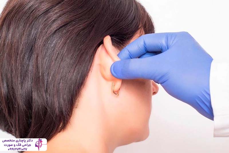 هزینه جراحی زیبایی گوش در تهران