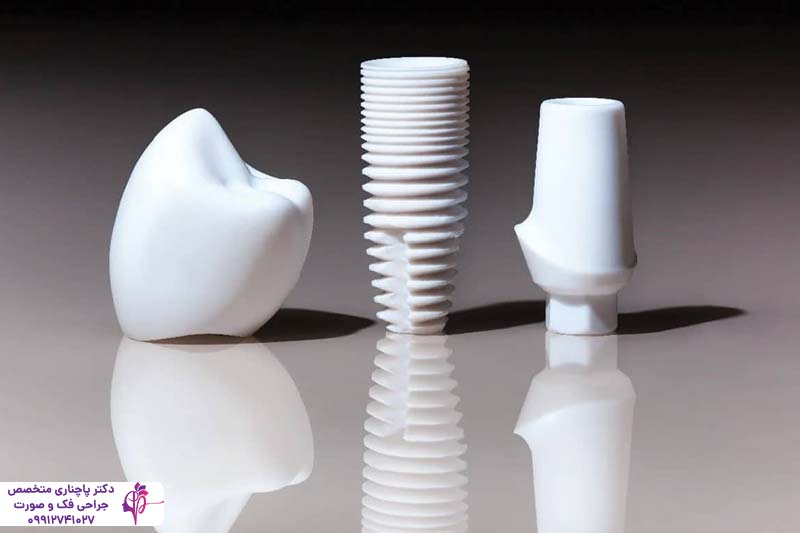ایمپلنت سرامیکی یا پایه تیتانیومی