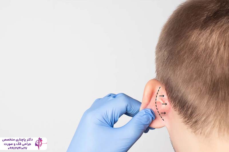 هزینه جراحی زیبایی گوش در تهران