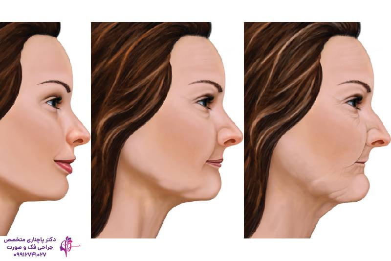 تحلیل استخوان فک