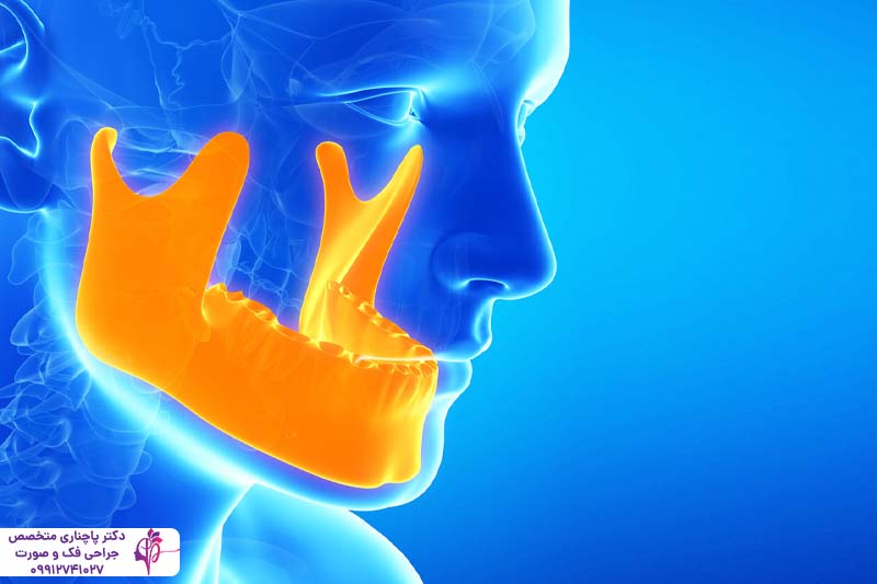 علت تریسموس بعد از جراحی دندان عقل