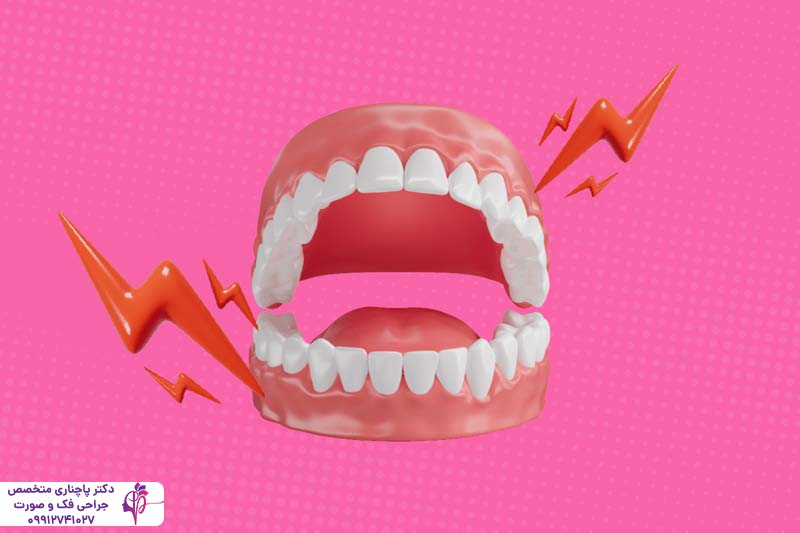 علت تریسموس بعد از جراحی دندان عقل