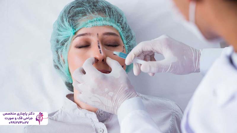 رینوپلاستی بدون جراحی