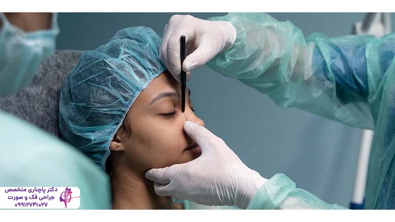 رینوپلاستی بدون جراحی