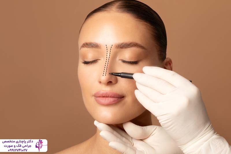 رینوپلاستی به روش پرزرویشن