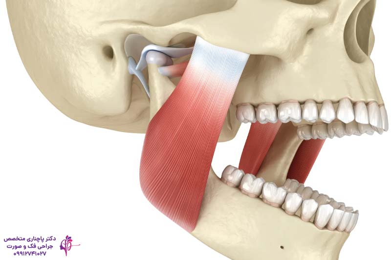 علت تریسموس بعد از جراحی دندان عقل