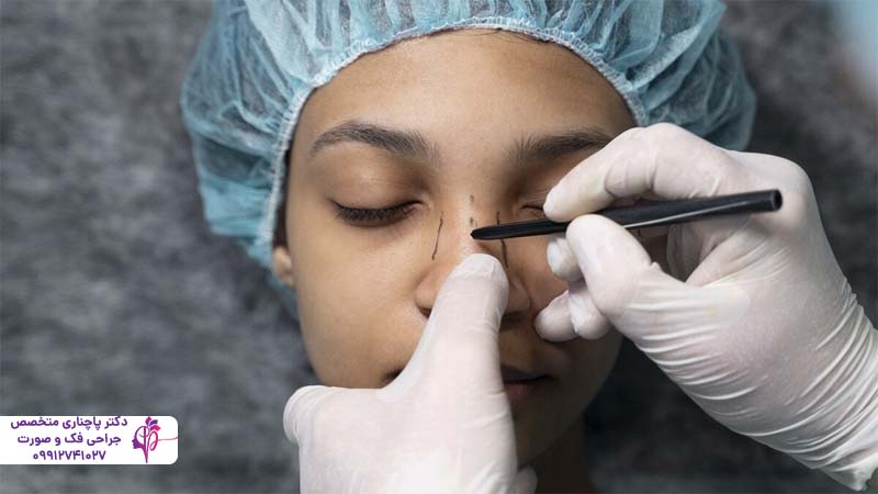 رینوپلاستی بدون جراحی