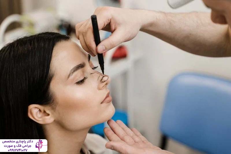 رینوپلاستی به روش پرزرویشن