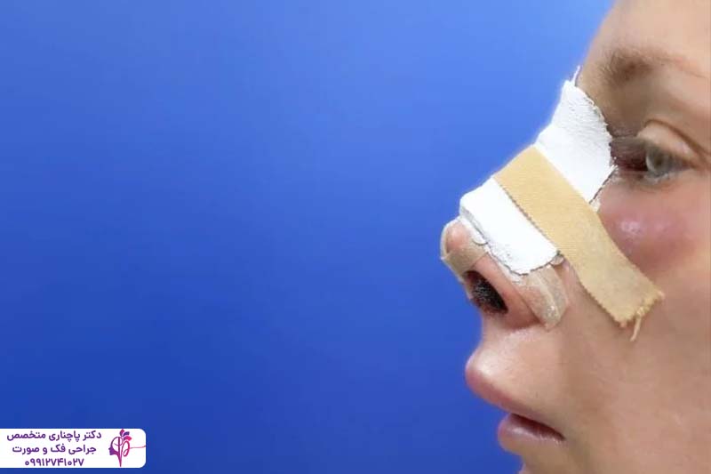 عمل بینی برای چه کسانی خطرناک است