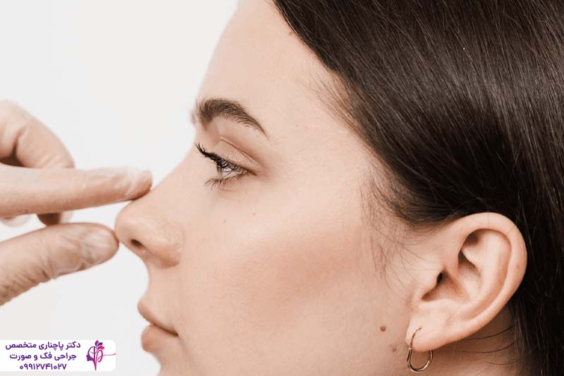 عمل بینی برای چه کسانی خطرناک است