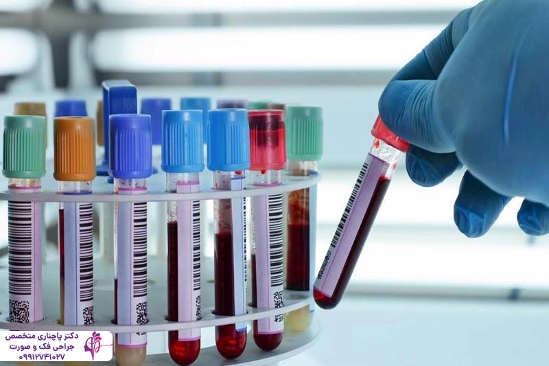 آزمایشات ضروری قبل از عمل بینی