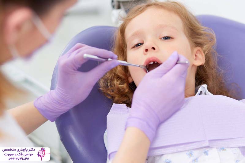 ایمپلنت دندان برای کودکان