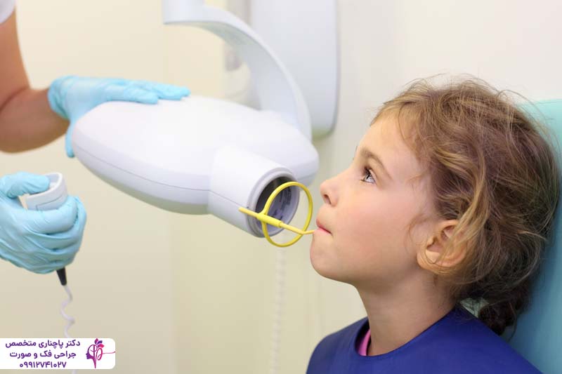 ایمپلنت دندان برای کودکان