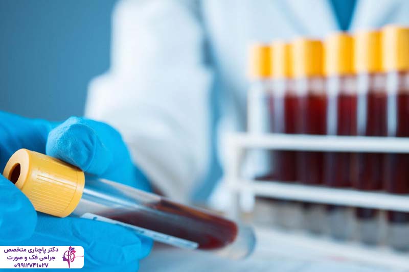 آزمایشات ضروری قبل از عمل بینی