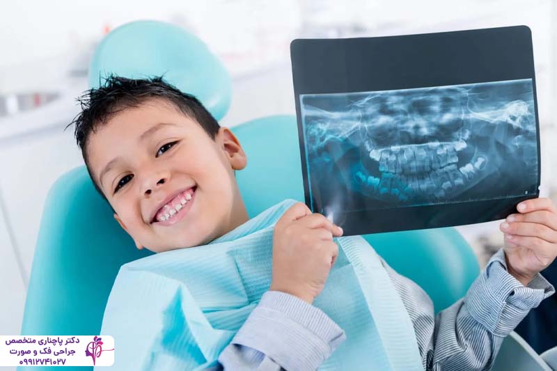 ایمپلنت دندان برای کودکان