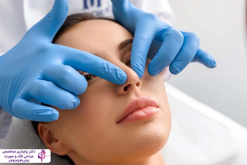 رینوپلاستی به روش اولتراسونیک