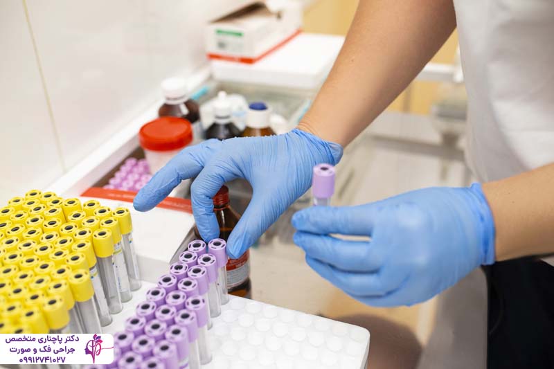 آزمایشات ضروری قبل از عمل بینی