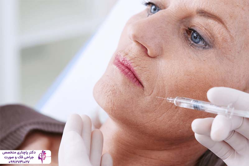 مراقبت‌های بعد از تزریق پروفایلو