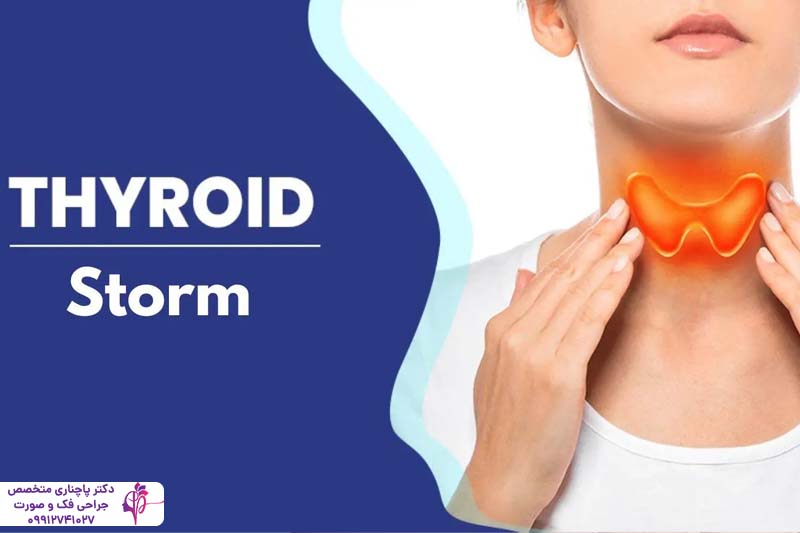 ایمپلنت دندان بیماران تیروئیدی