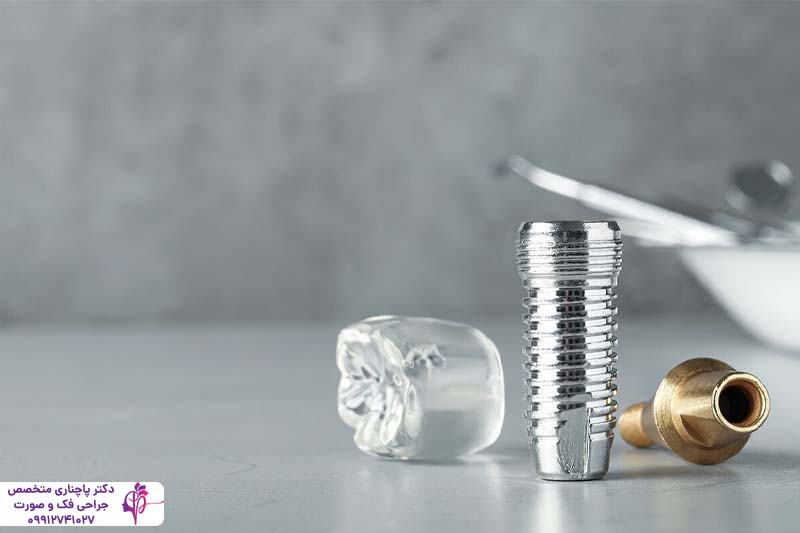 ایمپلنت آمریکایی زیمر Zimmer