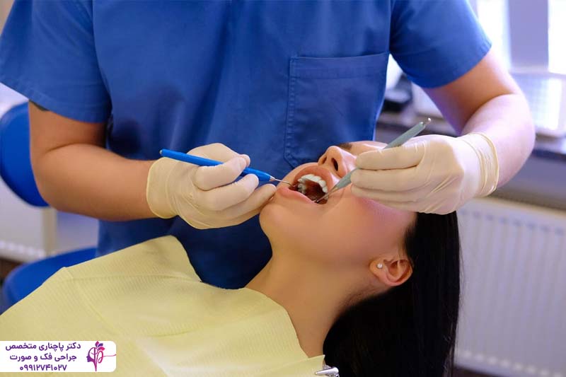 مزایا و معایب کشیدن دندان عقل