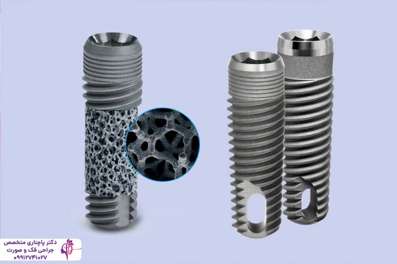 ایمپلنت آمریکایی زیمر Zimmer