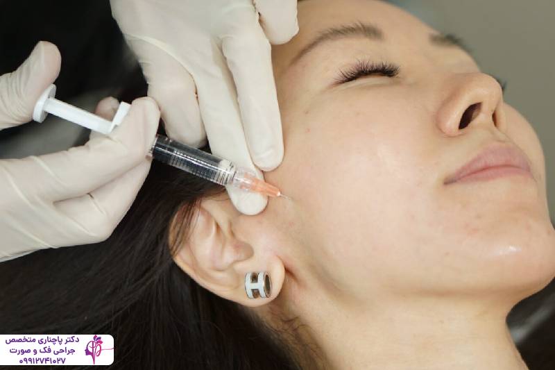 تزریق پروفایلو یا فیلر