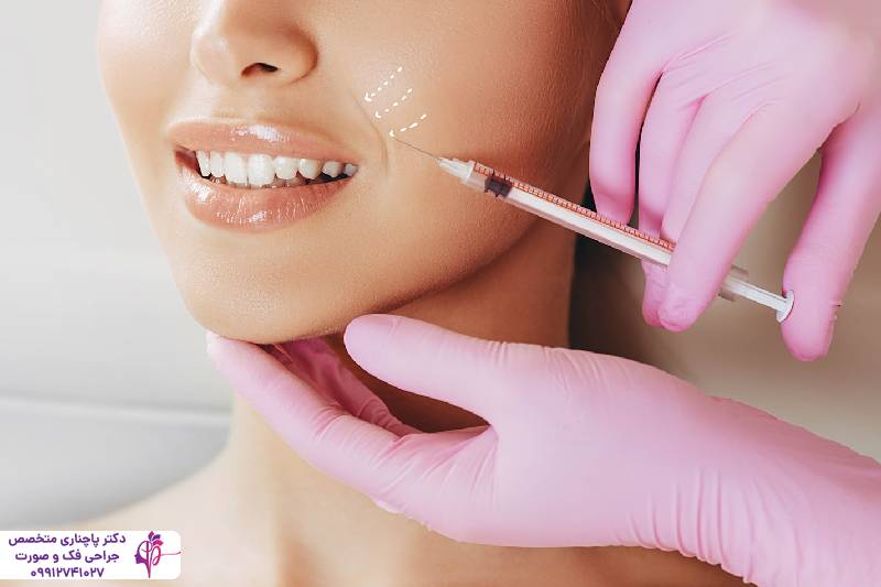 تزریق پروفایلو یا فیلر