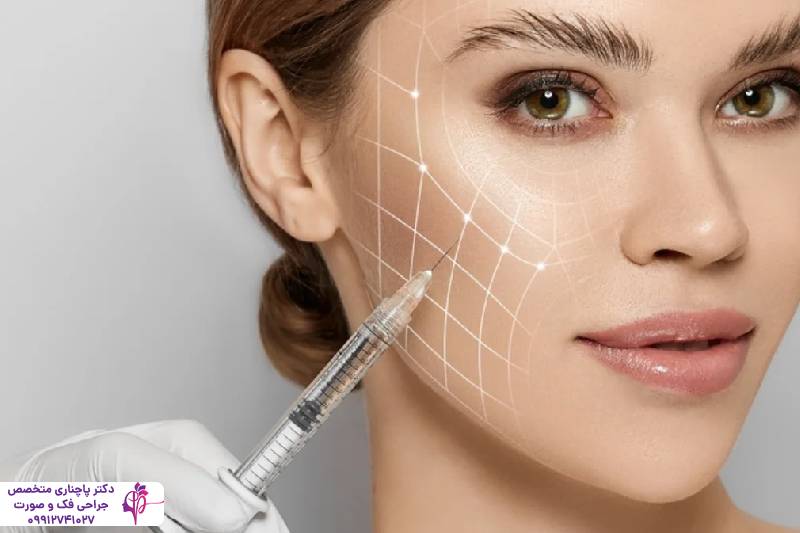 تزریق پروفایلو یا فیلر