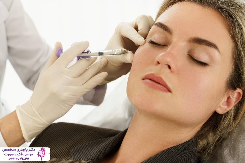 تزریق پروفایلو یا فیلر