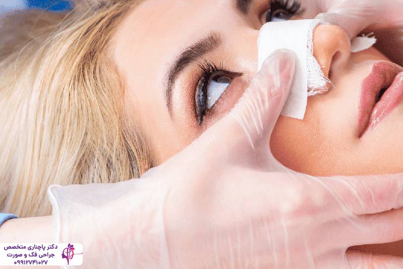 اصلاح بینی با تزریق فیلر یا عمل جراحی