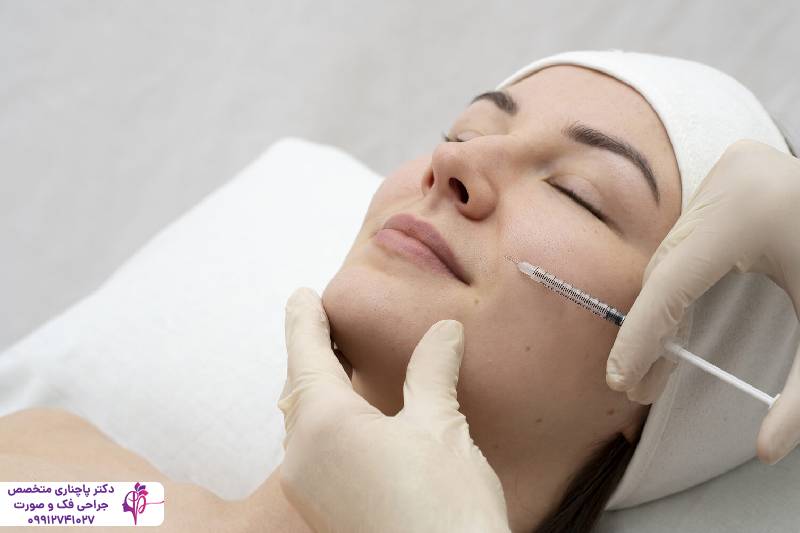 تزریق پروفایلو یا فیلر