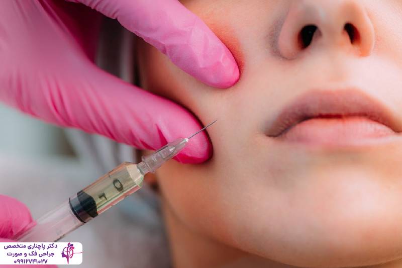 تزریق پروفایلو یا فیلر