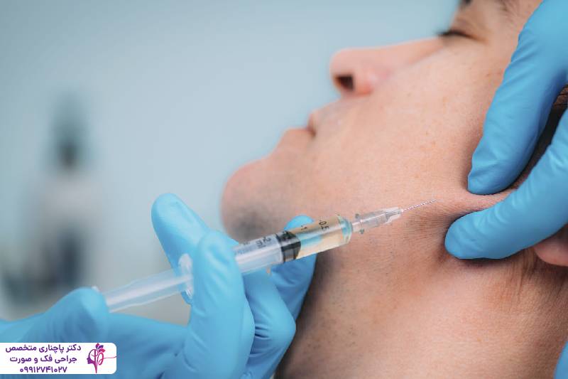 تزریق پروفایلو یا فیلر