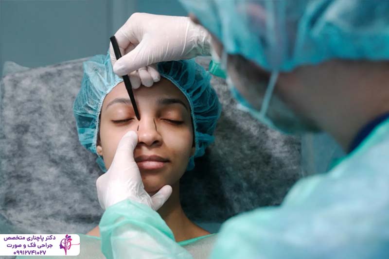 بهترین سن جراحی زیبایی بینی