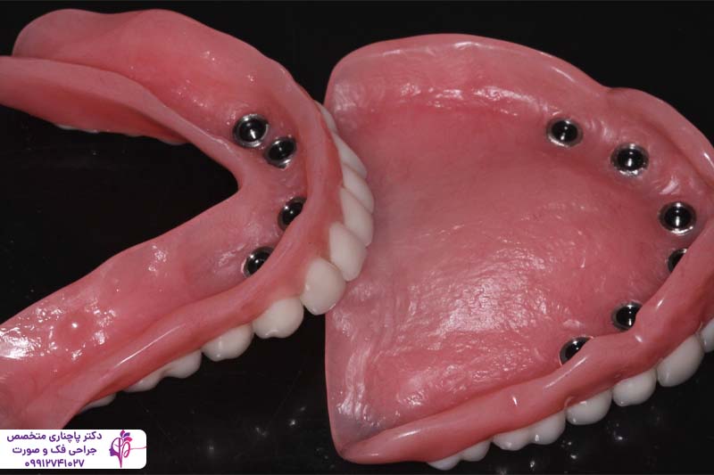 مرکز تخصصی اوردنچر در تهران