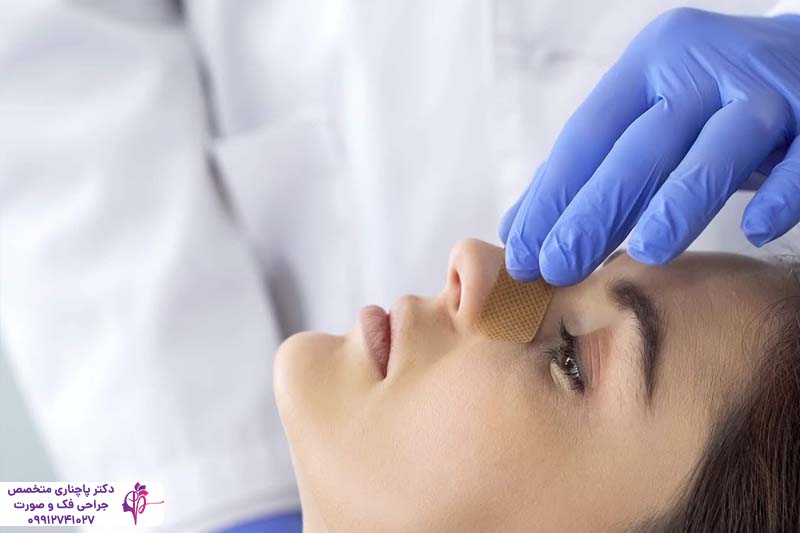 عمل پولیپ بینی همزمان با جراحی رینوپلاستی