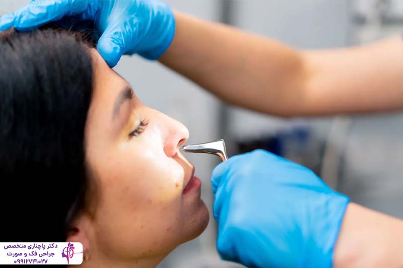 عمل پولیپ بینی همزمان با جراحی رینوپلاستی