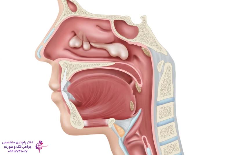 عمل پولیپ بینی همزمان با جراحی رینوپلاستی