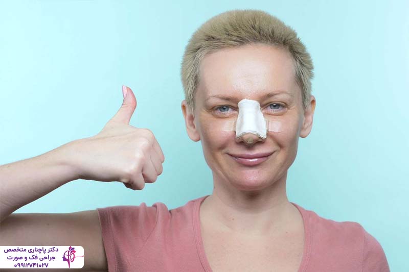 اسپلینت بینی