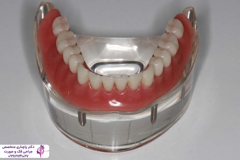 مرکز تخصصی اوردنچر در تهران