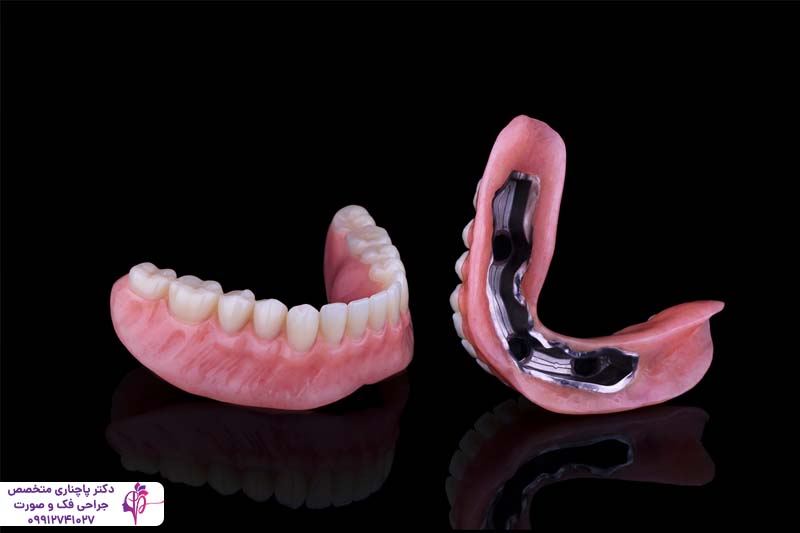 اوردنچر برای سالمندان