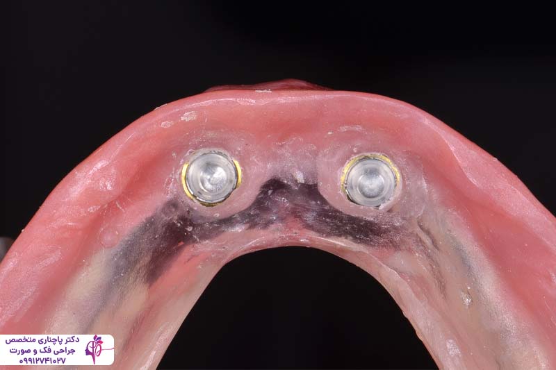 مرکز تخصصی اوردنچر در تهران